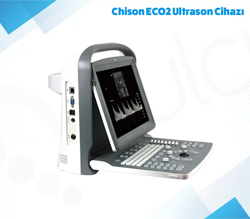 Chison ECO2 Ultrason Cihazı