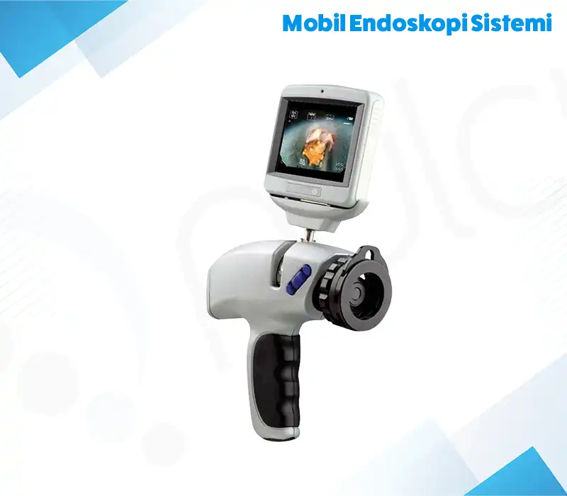 Mobil Endoskopi Sistemi