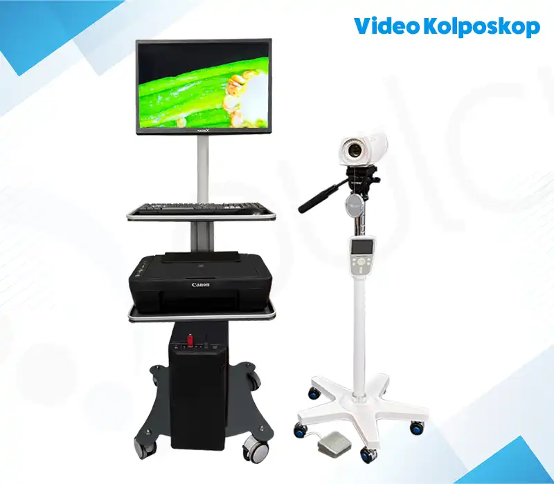 Video Kolposkop